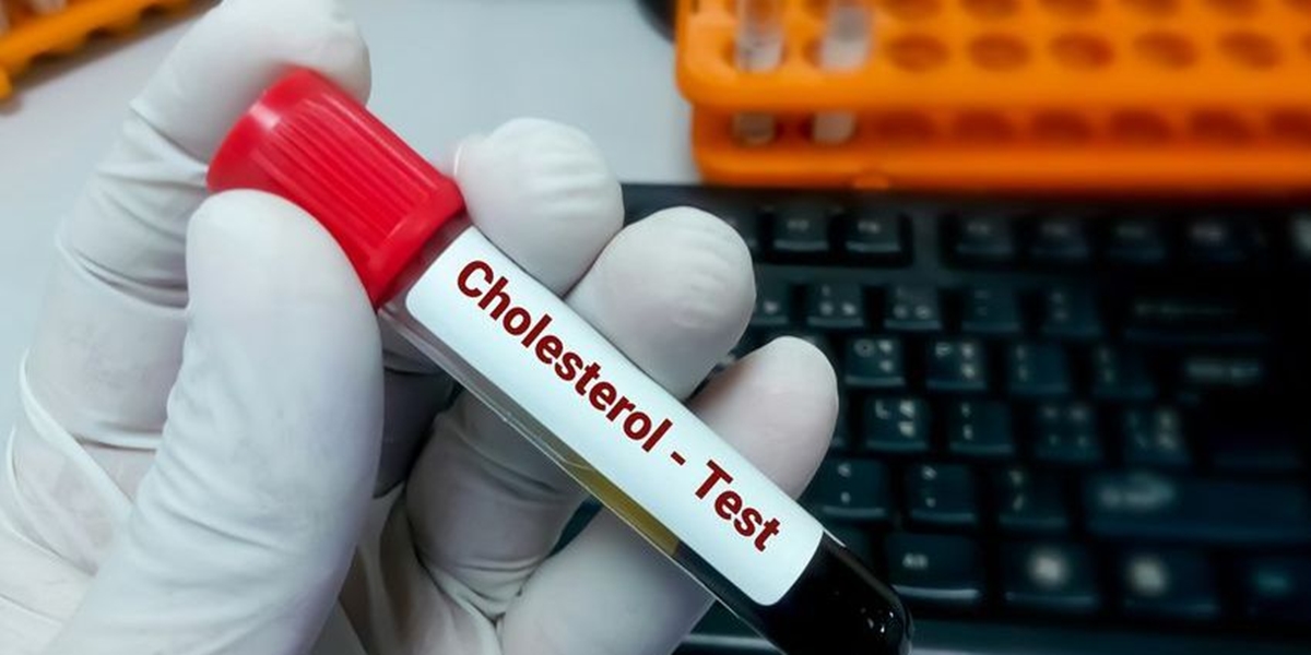 Bahaya Kolesterol Tinggi yang Sering Diabaikan