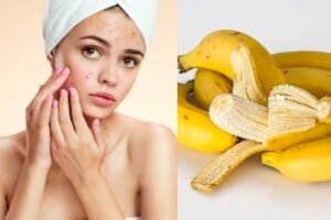 Manfaat dan Cara Aman Masker Pisang Alami