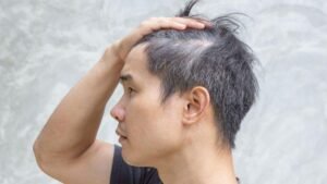 Tips Menjaga Rambut Hitam Sejak Usia Muda